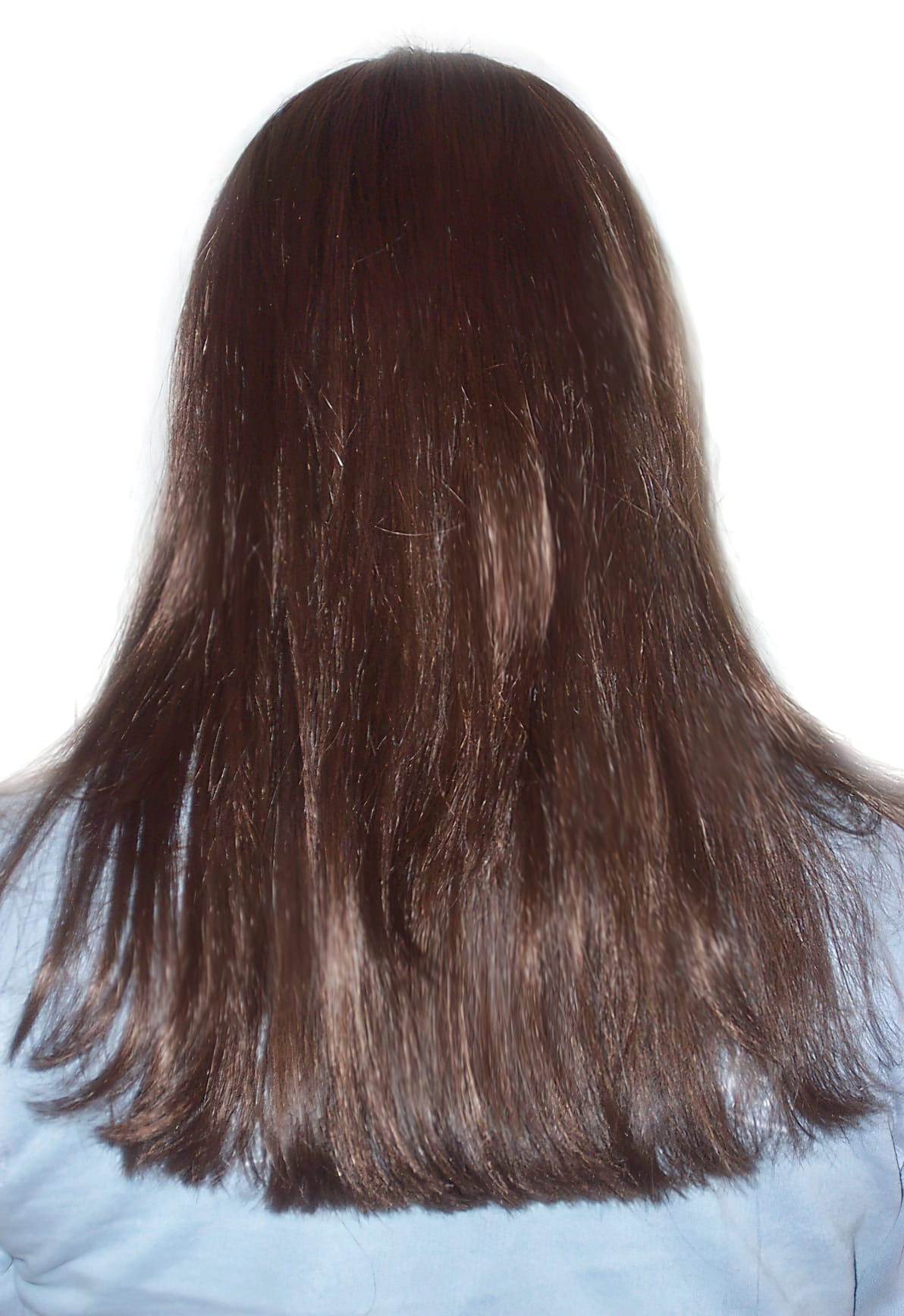 After Picture - Trichotillomania